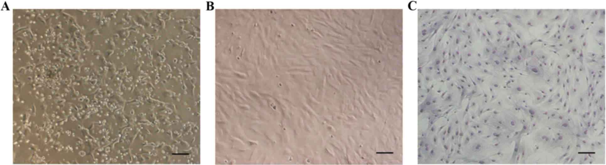 a k hardwood flooring ltd of effects of hsya on the proliferation and apoptosis of mscs exposed regarding a the majority of cells were adherent following 3 days of primary culture b third generation mscs exhibited a fibroblast or spindle like morphology