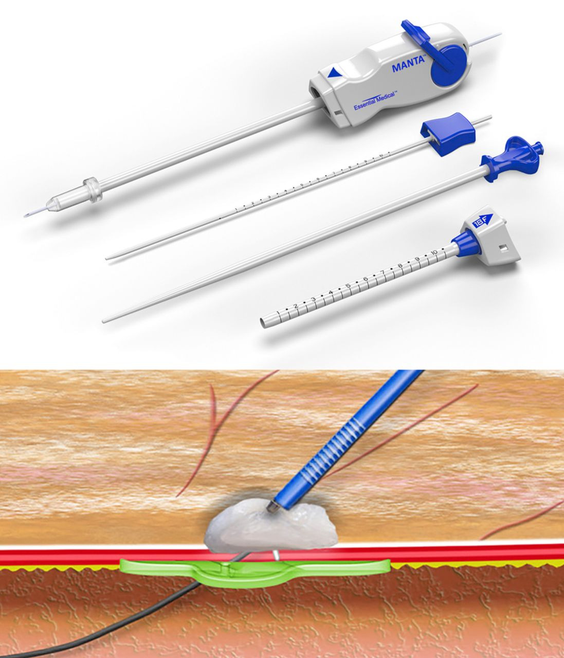 hardwood floor repair markers of percutaneous plug based arteriotomy closure device for large bore with regard to download figure